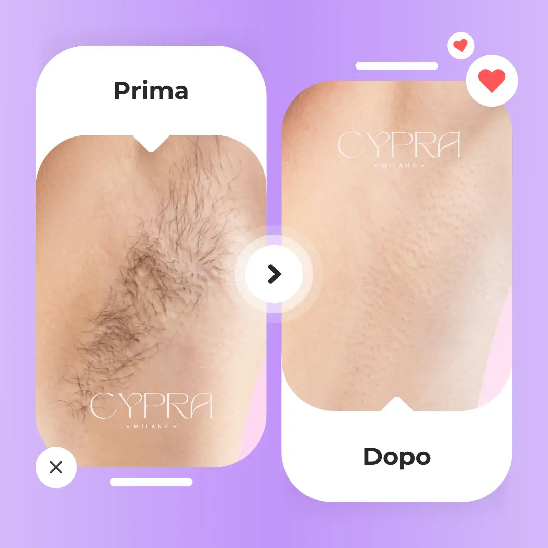 Cypra™️ - Il tuo alleato naturale contro i peli indesiderati